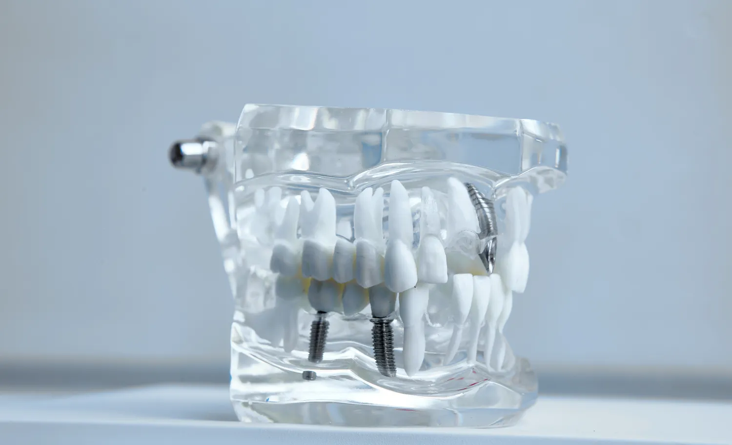 Najlepsza endodoncja Szczecin